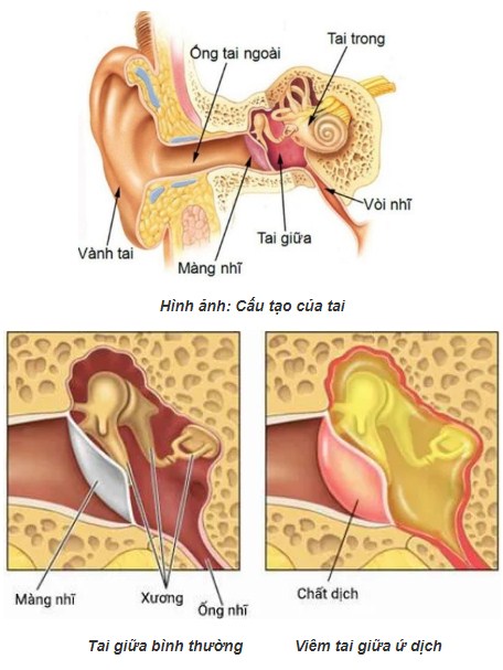 Cấu tạo của tai và bệnh viêm tai giữa ở trẻ em