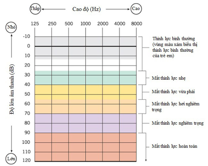 Đọc kết quả đo thính lực đồ